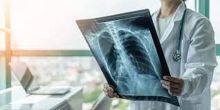 DIGITAL XRAY